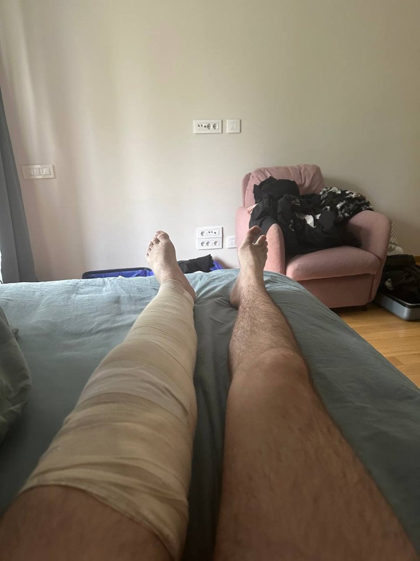 Miposhka injured his leg